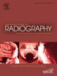 Go to journal home page - European Journal of Radiography